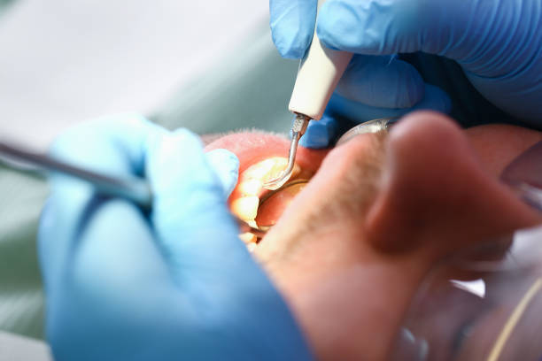 Best Emergency Tooth Extraction in Mammoth Spring, AR